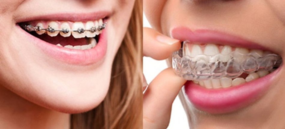 Best Orthodontics in Faridabad